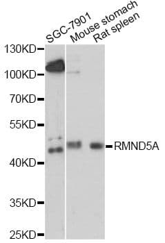 Polyclonal Rabbit anti-Human RMND5A Antibody (WB)