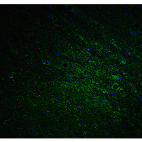 Polyclonal Rabbit anti-Human DCLK / DCLK1 Antibody (IHC, IF, WB)