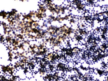PLK1 / PLK-1 Antibody