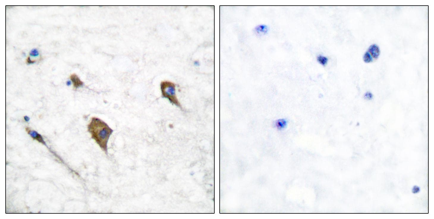 IL3RA / CD123 Antibody (phospho-Tyr593)