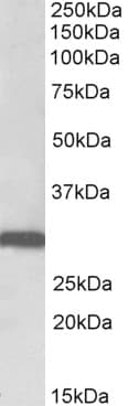 IHC-plus™ STOM / Stomatin Antibody (aa3-14)