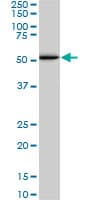 SMAD1 Antibody (clone 1D3)