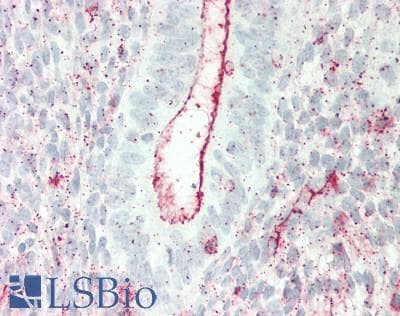 IHC-plus™ EGFR Antibody (Internal)