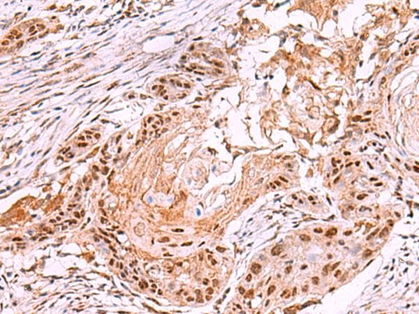 Polyclonal Rabbit anti-Human IRX4 Antibody (IHC, WB)