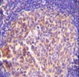 GRK6 Antibody (aa551-576)