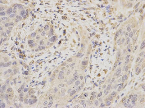 IHC-plus™ UBE2I / UBC9 Antibody
