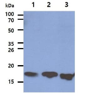 LSM5 Antibody (clone AT25F8)