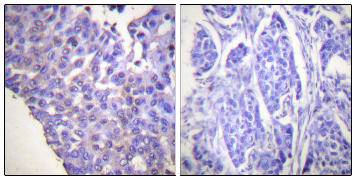 CALD1 / Caldesmon Antibody (phospho-Ser789)