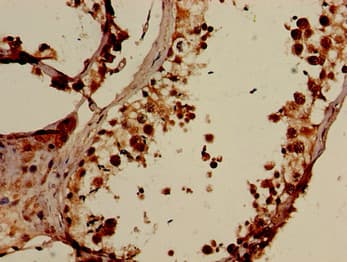 ELOVL4 Antibody