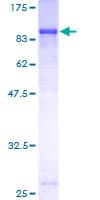 Human ECM1 Protein (Recombinant GST)