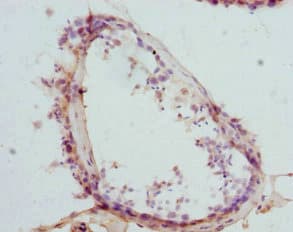 CTNNBL1 / NAP Antibody