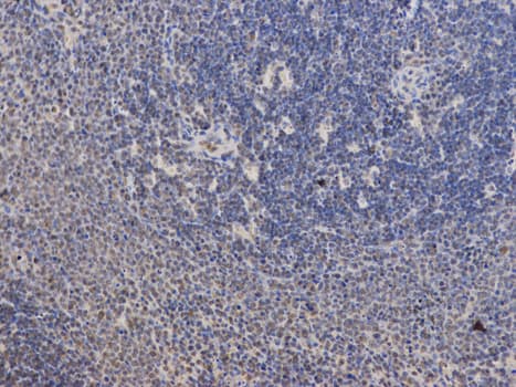 PPP2R2A Antibody
