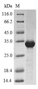 Wheat Trypsin/alpha-amylase inhibitor CMX2 Protein (Recombinant 10His-SUMO, N-terminus + Myc, C-terminus)