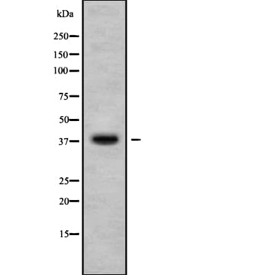 Polyclonal Rabbit anti-Human CA10 / Carbonic Andhydrase X Antibody (WB)