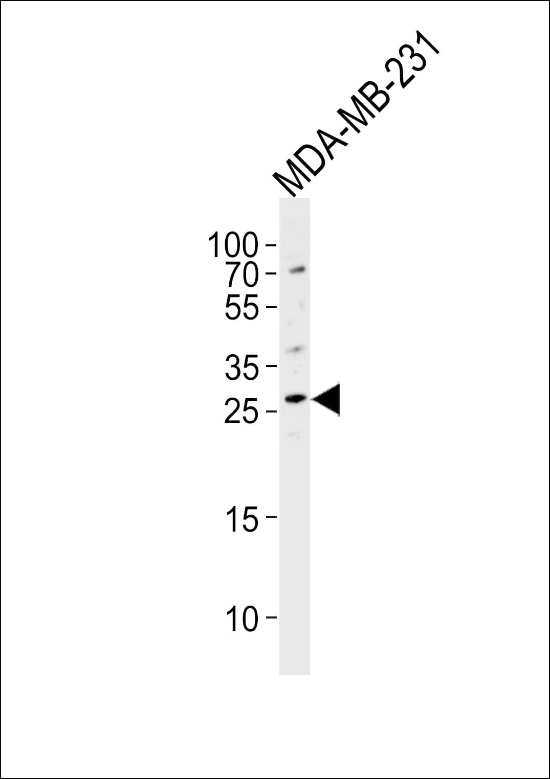 CRISP1 Antibody (aa162-191)
