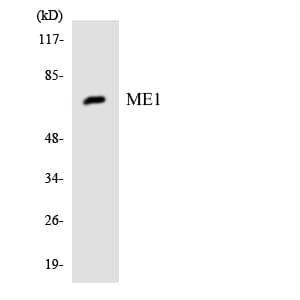 ME1 / Malate Dehydrogenase Antibody (aa451-500)
