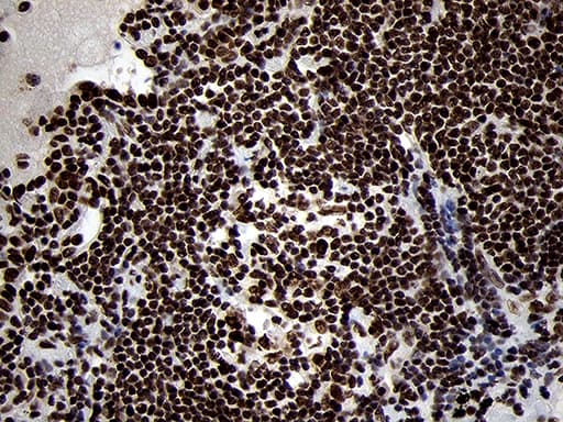 SMC1A / SMC1 Antibody (aa889-1016, clone OTI3G4, Carrier-free)