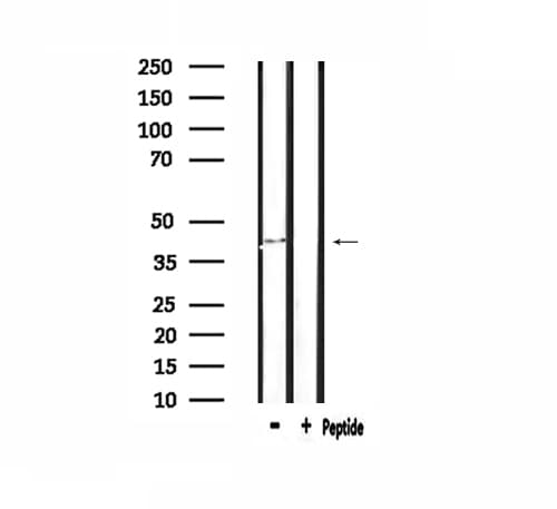 Polyclonal Rabbit anti-Human ST6GAL1 / CD75 Antibody (IHC, IF, WB)
