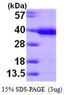 Human HUS1 Protein (Recombinant His)