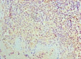 SMC1A / SMC1 Antibody (aa1-130)