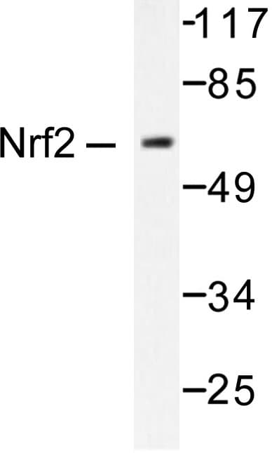 Polyclonal Rabbit anti-Human NFE2L2 / NRF2 Antibody (Leu593, IHC, WB)