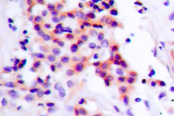 RELA / NFKB p65 Antibody (phospho-Ser468)