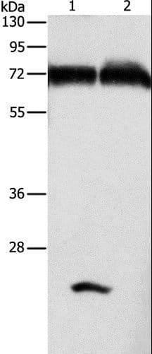 Polyclonal Rabbit anti-Human GDPD5 Antibody (WB)