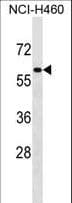 ZNF37A Antibody (aa71-100)