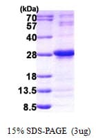 Human NUDT4 Protein (Recombinant His)