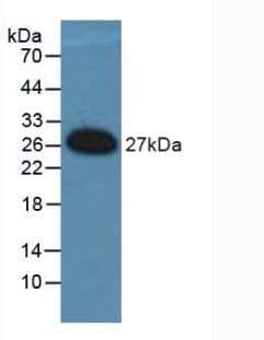 FRA-1 / FOSL1 Antibody (aa1-271, APC)