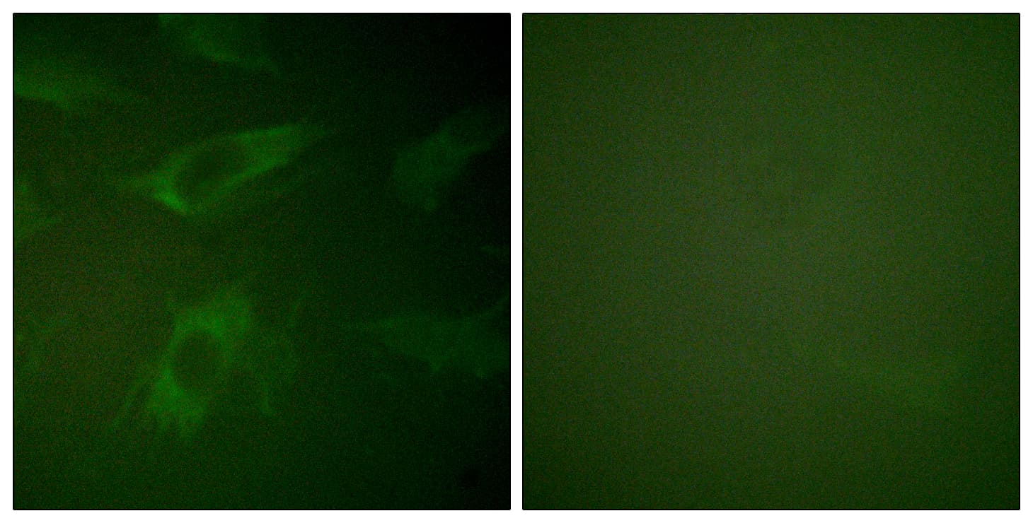 Polyclonal Rabbit anti-Human RPH3A / Rabphilin 3A Antibody (aa203-252, IHC, IF, WB)