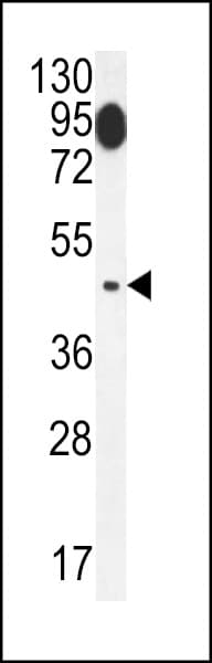 IHC-plus™ SLC29A1 / ENT1 Antibody (aa234-263)