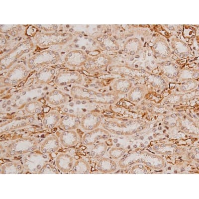 Polyclonal Rabbit anti-Human c-Kit / CD117 Antibody (IHC, IF, WB)
