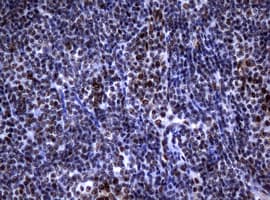 NBN / Nibrin Antibody (clone OTI2E9)