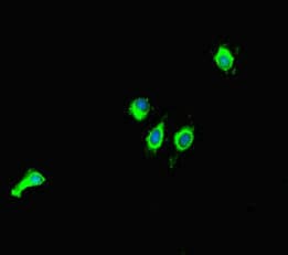SIRT1 / Sirtuin 1 Antibody