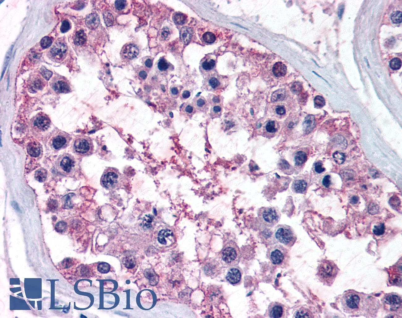 IHC-plus™ NR0B1 / DAX1 Antibody (N-Terminus)