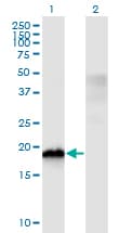 IHC-plus™ CIRP / CIRBP Antibody (clone 1C9)