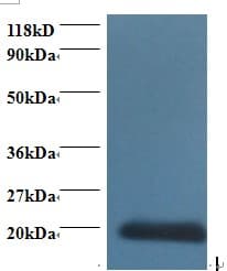 CDA / Cytidine Deaminase Antibody
