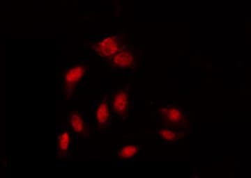 Polyclonal Rabbit anti-Human GATA1 Antibody (phospho-Ser310, IF, WB)