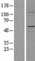 Human GFAP Protein (Over-Expression Lysate Myc-DDK (Flag))