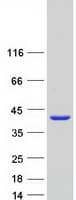 Human MPST Protein (Recombinant Myc-DDK (Flag))