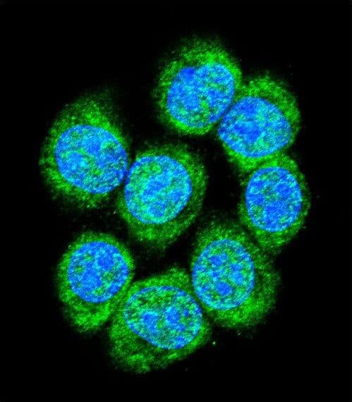 CTNNB1 / Beta Catenin Antibody (aa646-673)