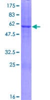 Human DHRS1 Protein (Recombinant GST)