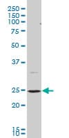 BAP29 / BCAP29 Antibody (clone 4B10)