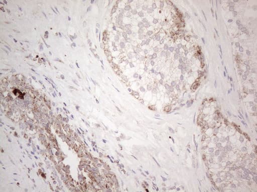 Monoclonal Mouse anti-Human ANGPTL8 / Betatrophin Antibody (clone OTI1B12, Carrier-free, aa22-198, IHC, WB)