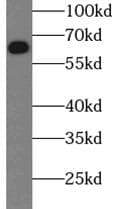 SQSTM1 Antibody