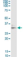LGALS8 / Galectin 8 Antibody (clone 3E5)