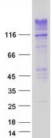 Human RNF213 Protein (Recombinant Myc-DDK (Flag))