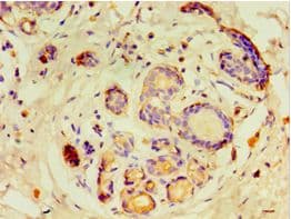 Polyclonal Rabbit anti-Human GTF2H2C Antibody (aa1-260, IHC)
