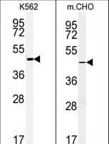 ENTPD8 Antibody (aa396-423)